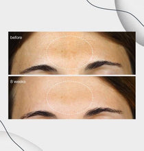 Load image into Gallery viewer, Powerbright dark spot serum