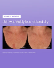 Load image into Gallery viewer, New stabilising repair serum